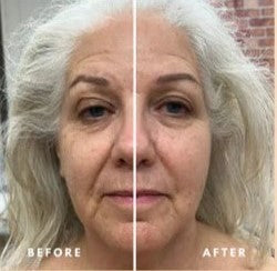 FLUFEEZ™ Lymphatic Face Brush